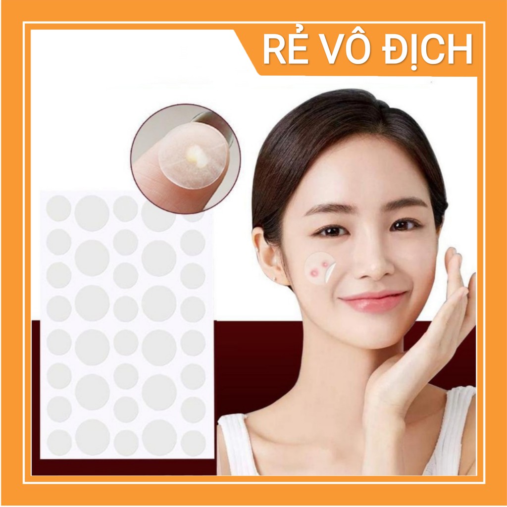Combo 36 miếng dán mụn, hiệu quả xẹp mụn nhanh | BigBuy360 - bigbuy360.vn
