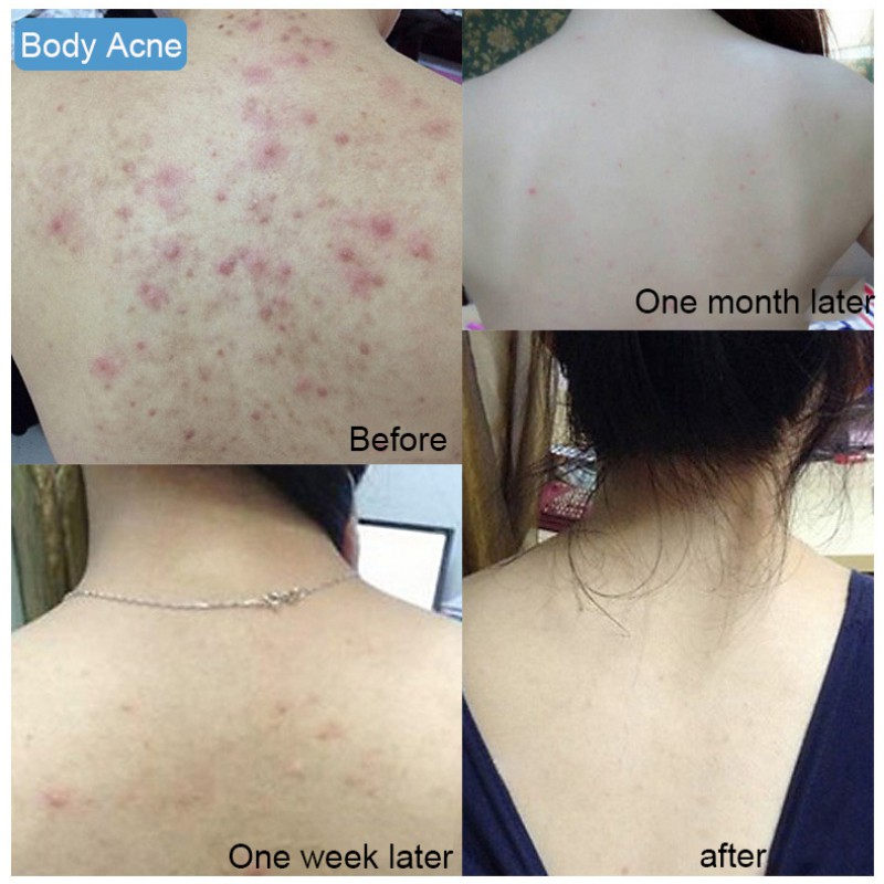 Xà Phòng Muối Biển Tạo Bọt Nhanh Chóng Loại Bỏ Găng Tay Nuôi Dưỡng Da Cá Nhân