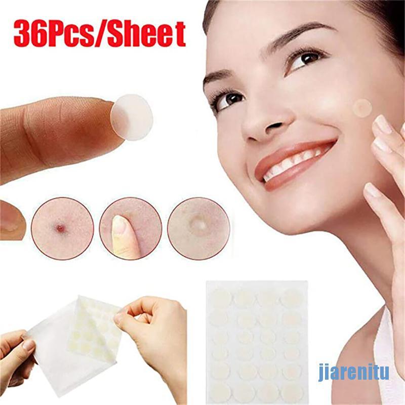 （hot*cod）36Pcs Skin Tag & Acne Patch Hydrocolloid Acne and Skin Tag Remover Patches