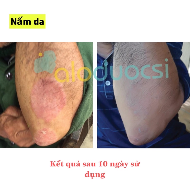 Xịt kháng khuẩn Maxibac