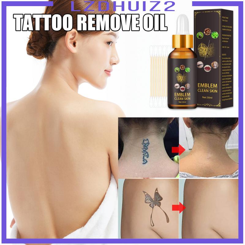 Dung Dịch Loại Bỏ Hình Xăm Vĩnh Viễn An Toàn 30ml