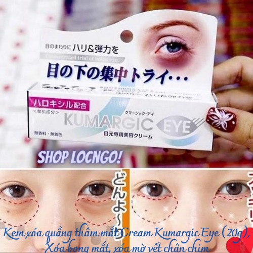 Kem trị  thâm quầng mắt Cream Kumargic Eye (20g),Xóa bọng mắt, xóa mờ vết chân chim Không gây kích ứng da-by Shop LocNgo