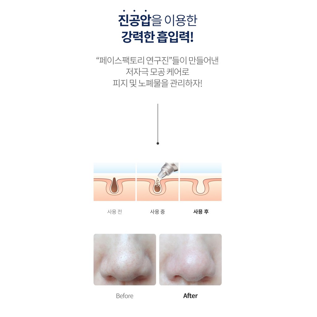 Máy hút mụn Beauty Suction Hàn Quốc