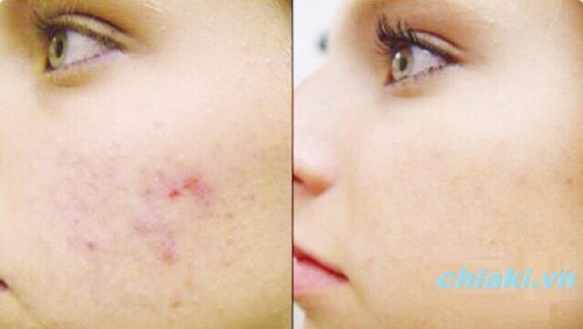 Nước hoa hồng Toner Cc Melano trắng da Nhật Bản - lotion cc melano | BigBuy360 - bigbuy360.vn