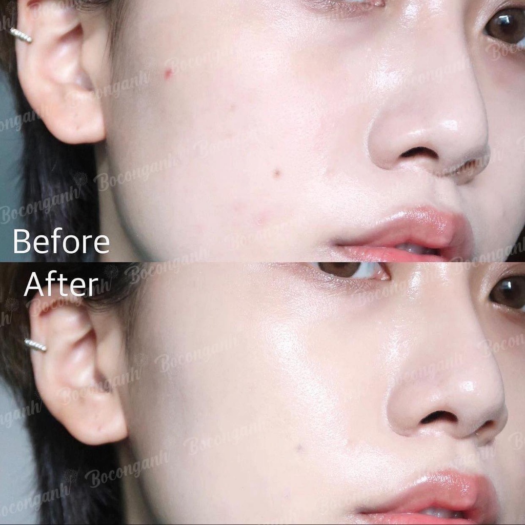 SERUM CẤP ẨM PHỤC HỒI MEDIPHAR B5 30ML