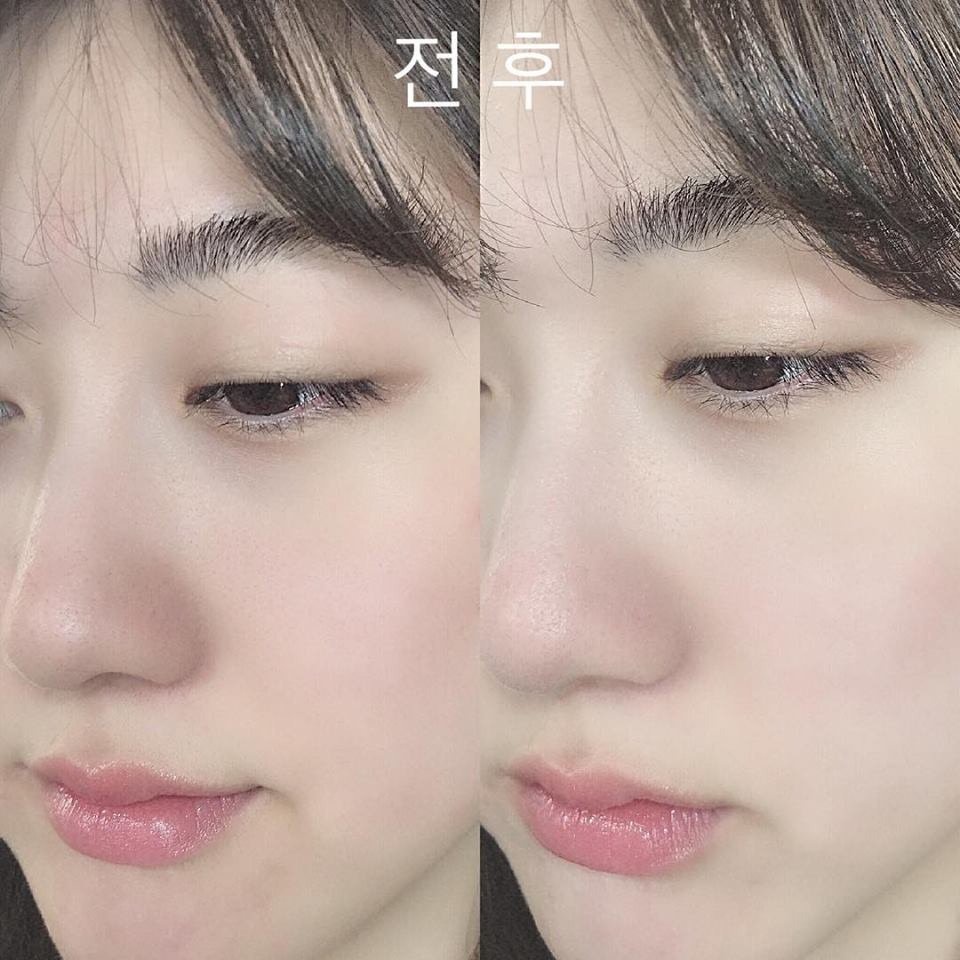Kem Dưỡng Trắng Da Melasma-X 3D Glutathione Tone Up Cream