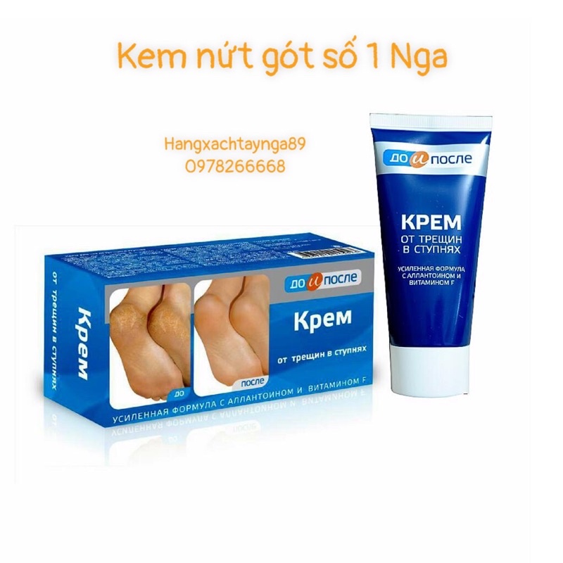 Kem giảm nứt nẻ gót chân Kpem Apteka của Nga 50ml Date mới