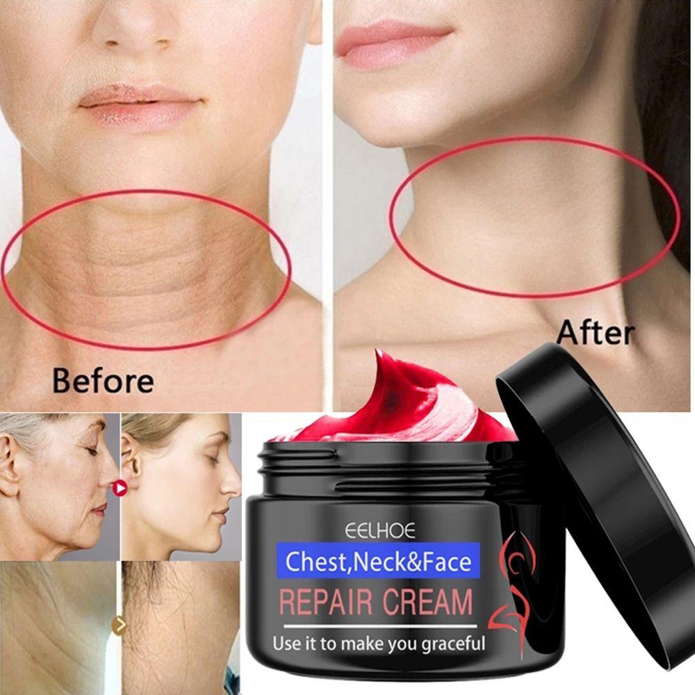 ME Kem Dưỡng Trắng Da Mặt Làm Mờ Nếp Nhăn Và Làm Săn Chắc Da