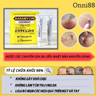 Kem bôi loại bỏ mụn cóc, mụn cơm baramycin 10g
