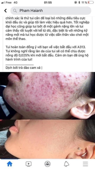 Kem A313 retinol chính hãng có BILL mua tại Pháp