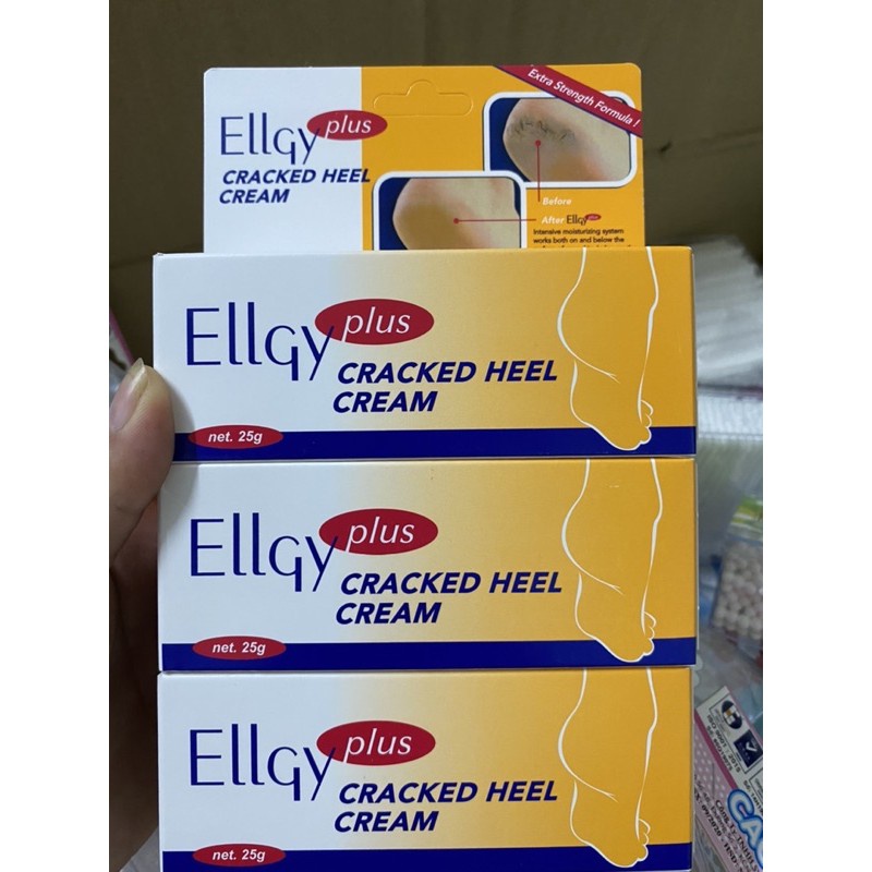 Cream trị nứt gót chân Ellgy 25g