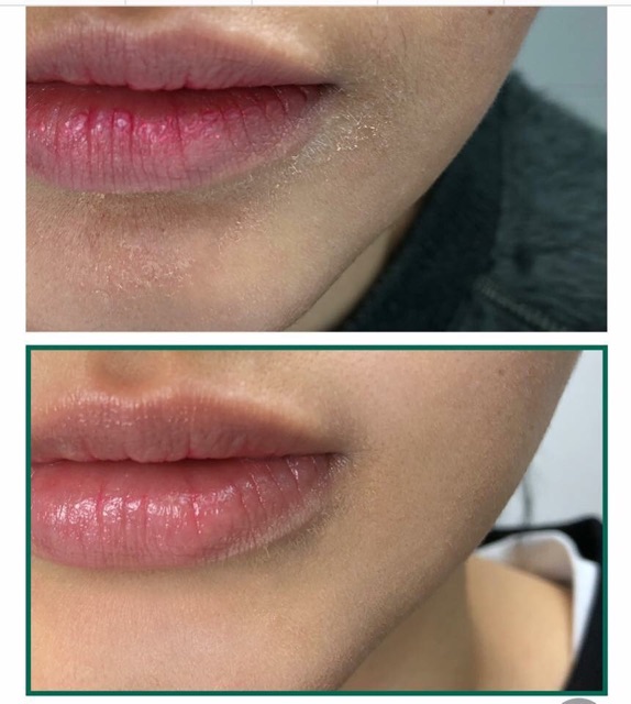 Nước hoa hồng da mụn AHA-BHA-PHA 30 Days Miracle Toner Some By Mi | BigBuy360 - bigbuy360.vn