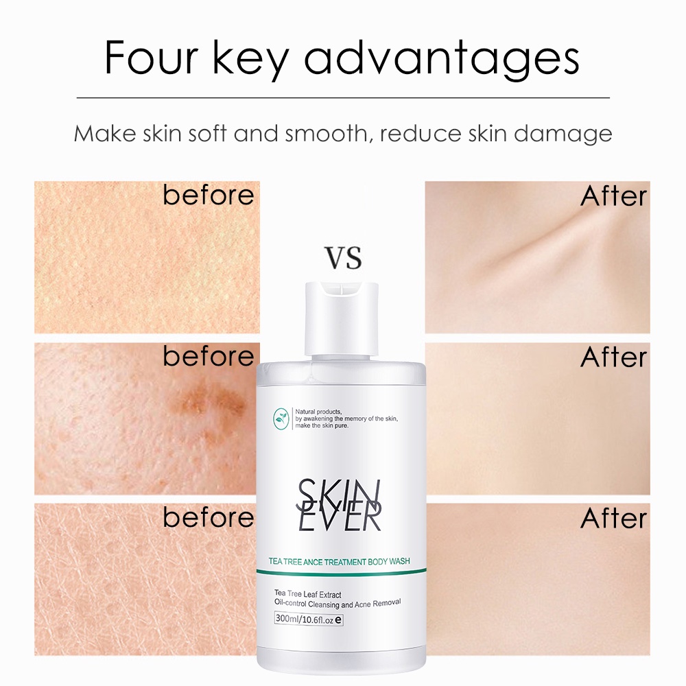 Sữa tắm SKIN EVER chiết xuất trà xanh kháng khuẩn kiểm soát dầu cho cơ thể 200ml