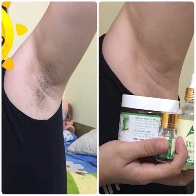 Combo triệt lông An Lành(tặng dụng cụ wax) | BigBuy360 - bigbuy360.vn