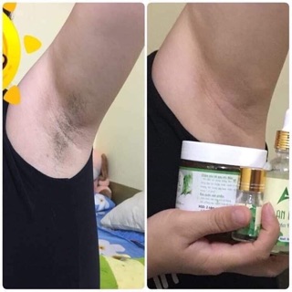Combo triệt lông An Lành(tặng dụng cụ wax)