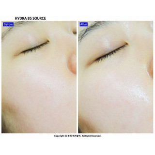 Tinh Chất Dưỡng Sáng Da , Chống Lã Hóa Ciracle Hydra B5 Source Wrinkle 30ml