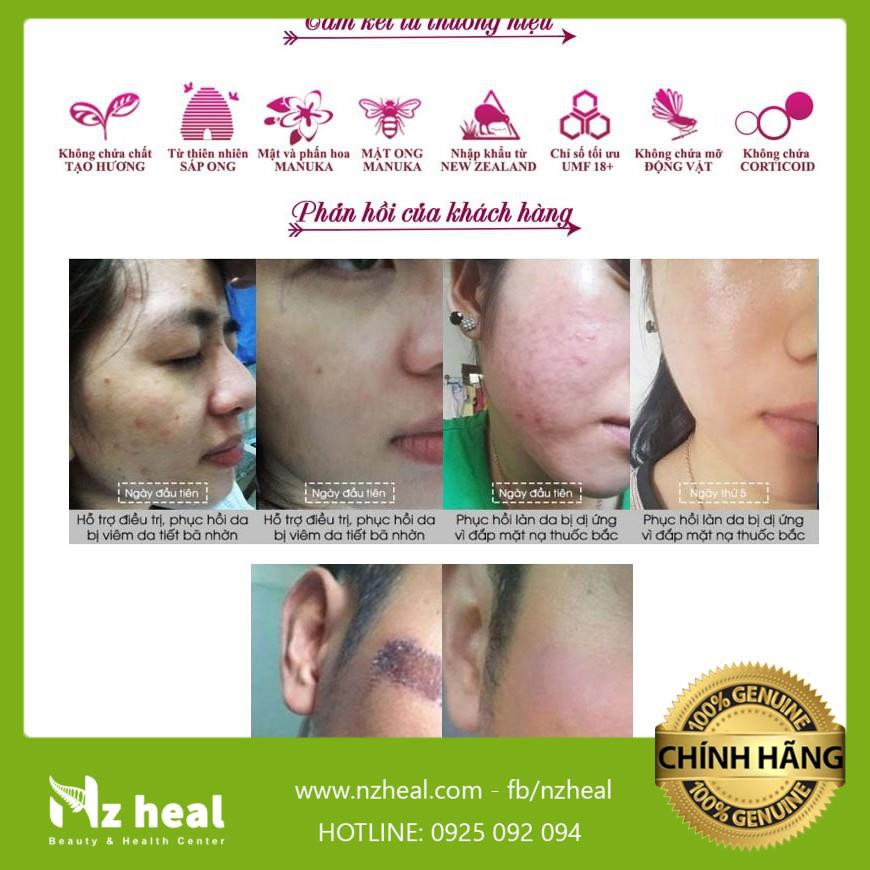 Kem Mật Ong Manuka 18+ Giảm Mụn, Mờ Thâm, Làm Dịu Da Dị Ứng Skin Health Crème hàng chính hãng | BigBuy360 - bigbuy360.vn