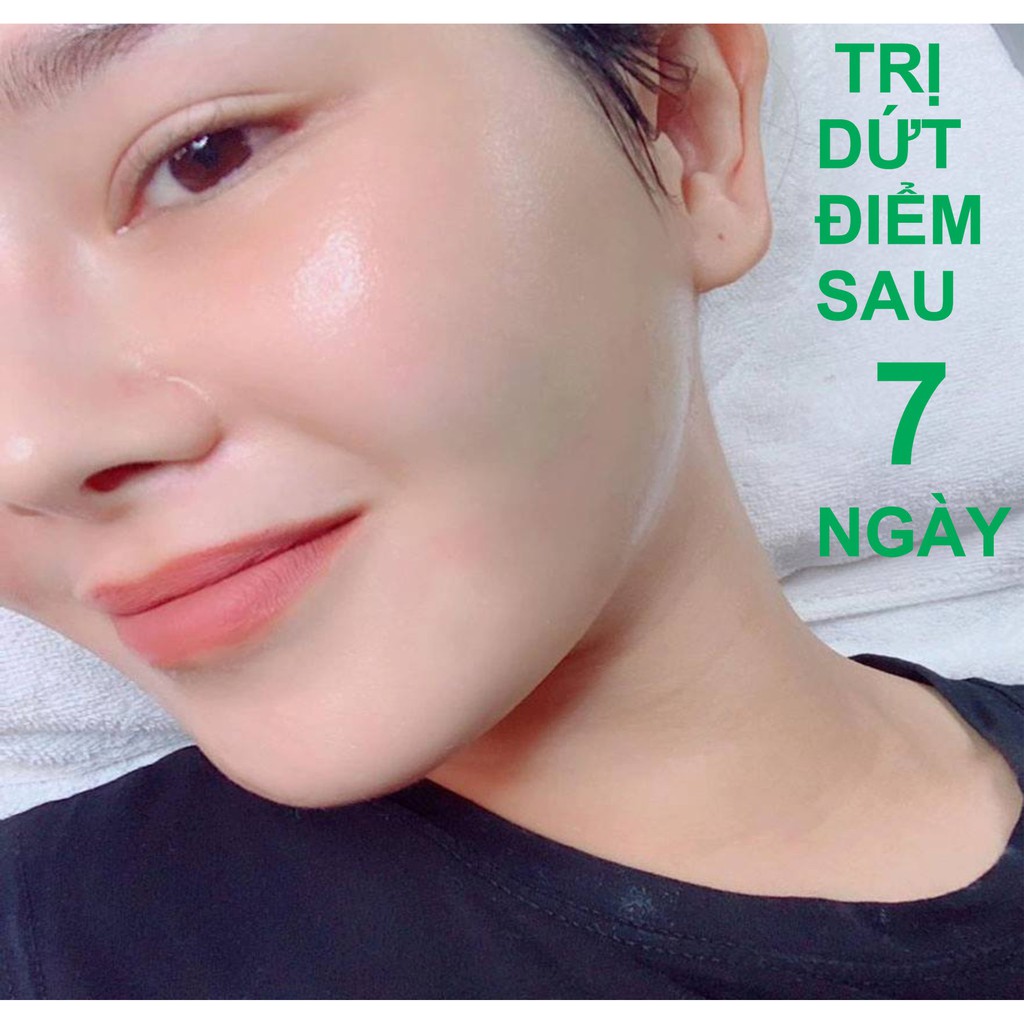 Serum tri mụn xóa thâm sẹo rổ nám tàn nhang EBeauty Viral 10ml