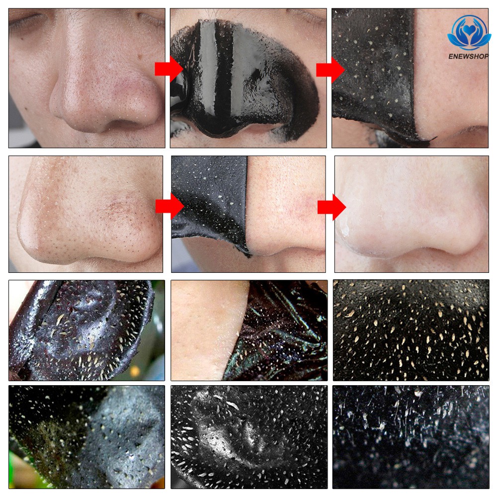 Mặt nạ lột mụn đầu đen LANBENA làm sạch sâu cho vùng da mũi | BigBuy360 - bigbuy360.vn