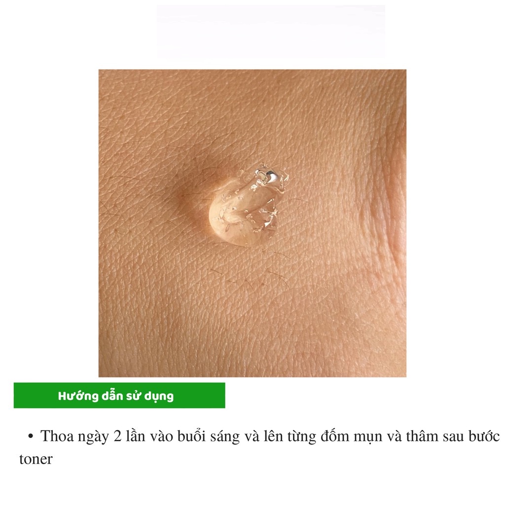 Gel Giảm Mụn Ẩn Và Thâm Gamma Megaduo Gel 15 gram