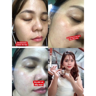 Kem tái tạo Chamomileskill -  Hộp 30Gram Mẫu Mới 2025