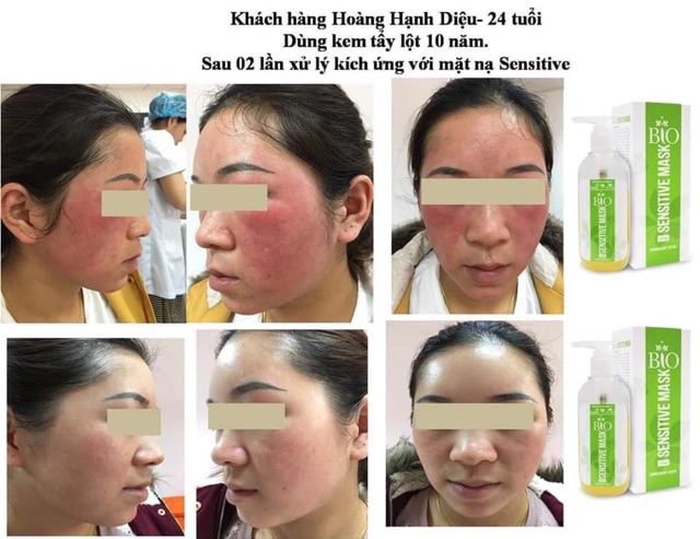 Mặt nạ thải độc cho da nhạy cảm bio sensitive mask organic công nghệ sinh học