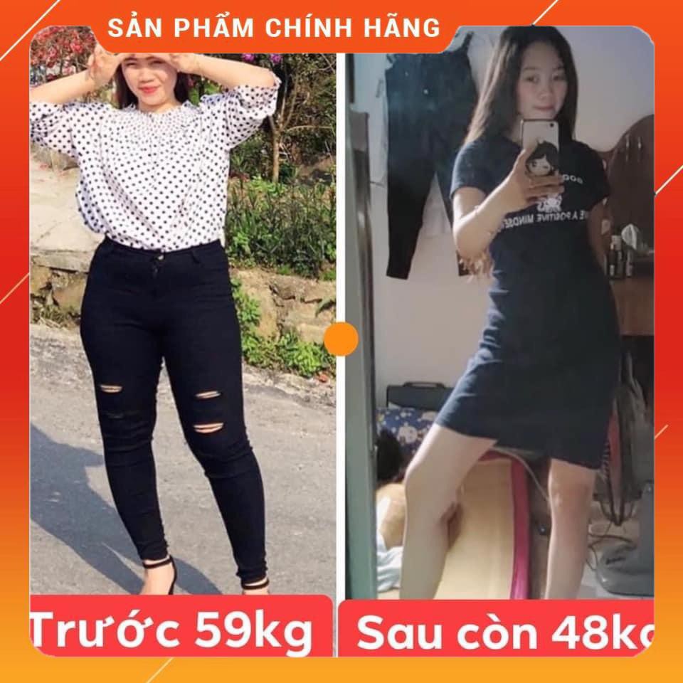 SHAN TUYẾT VIỆT - Viên uống Giảm Mỡ - Giảm 6 - 8kg Sau Liệu Trình - Không Cần Ăn Kiêng - Không Tăng Cân Lại - Giá Ưu Đãi