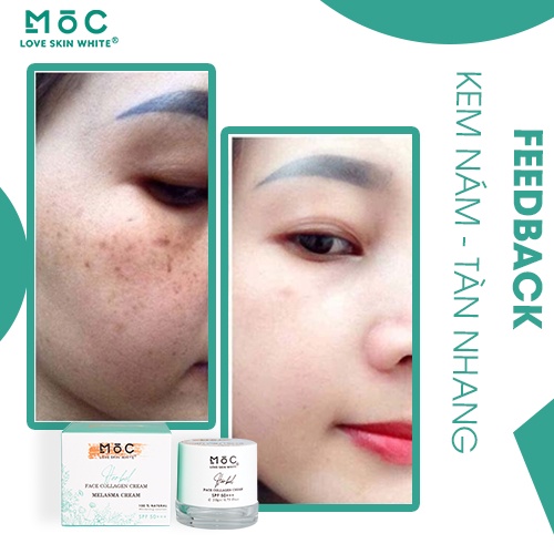 Kem dưỡng trắng da ngừa nám, tàn nhang Collagen Love Skin White Mộc 20g