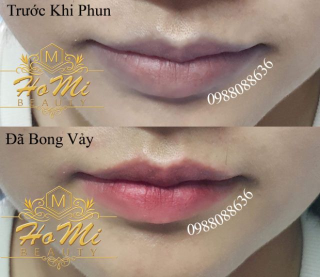 Phun môi collagen(chat để nhận giảm giá)