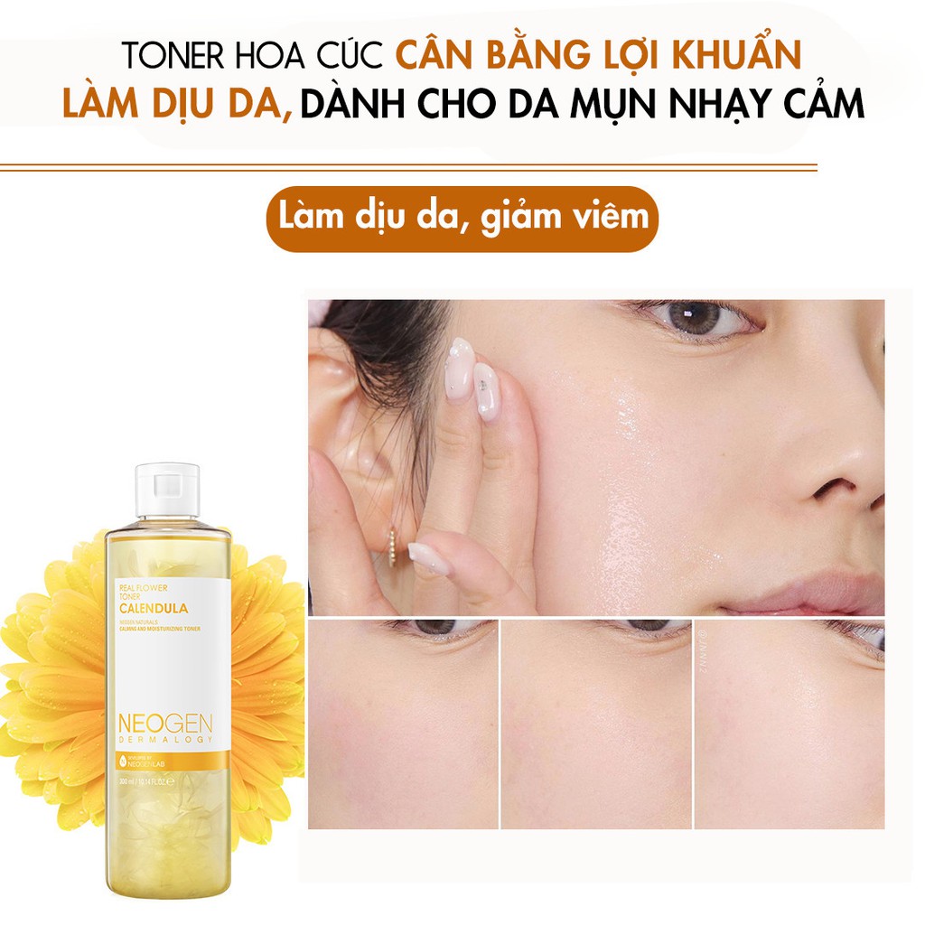 Toner Hoa Cúc Cân Bằng Lợi Khuẩn, Làm Dịu Da, Siêu Cấp Ẩm Cho Da Mụn Nhạy Cảm Neogen Dermalogy 300ml | BigBuy360 - bigbuy360.vn