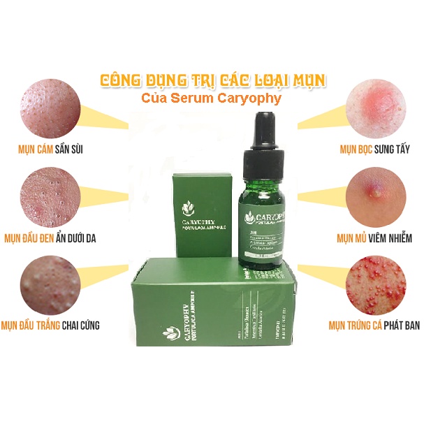 Tinh chất giảm mụn 10ml - Caryophy Portulaca Ampoule Serum 3in1