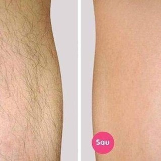 Kem tẩy lông Veet Pháp