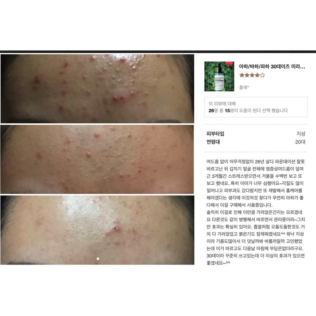 Bộ 3 món dưỡng da Some By Mi AHA- BHA-PHA 30 Days Miracle FULLSIZE | BigBuy360 - bigbuy360.vn