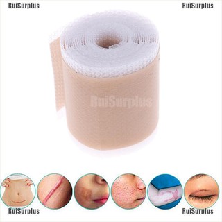 Ruisurplus❥ Băng Keo Dán Hỗ trợ giảm sẹo Hiệu Quả Bằng Silicone 4X150Cm