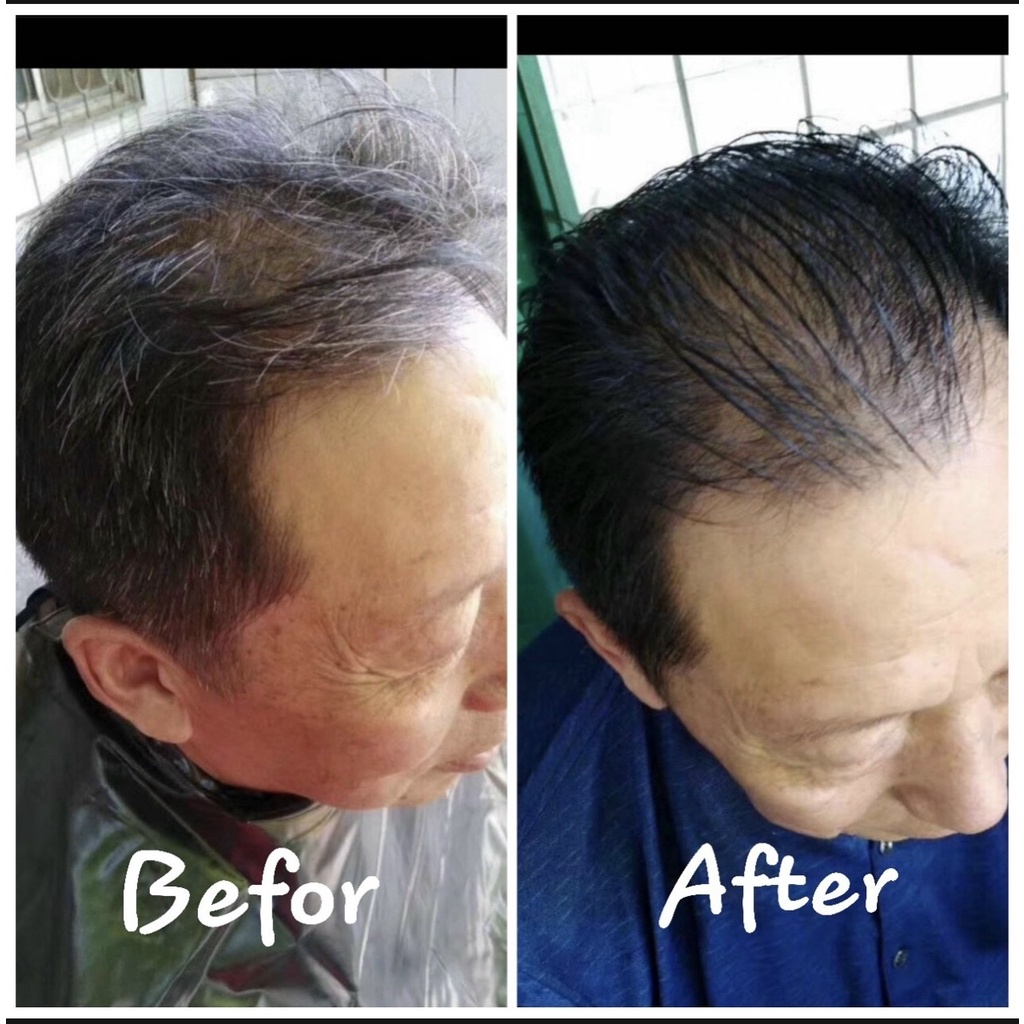 Nhuộm đen HD - Không Dính Da Đầu