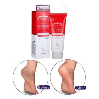 Kem dưỡng da chân 3W Clinic ngăn ngừa khô da và dưỡng ẩm 100ml Hàn Quốc