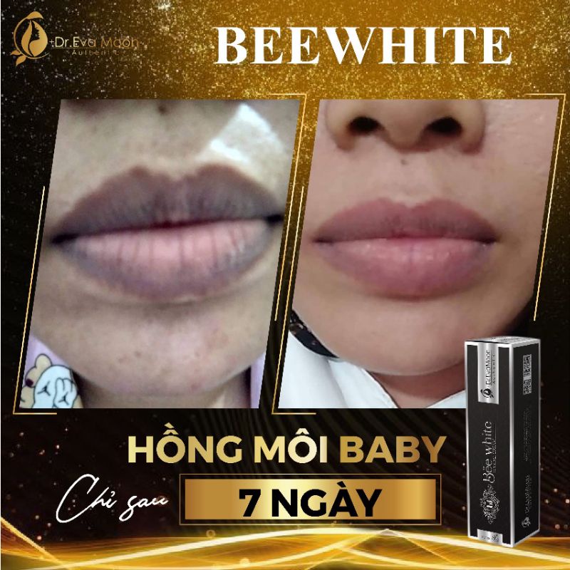 Làm Hồng nhũ hoa, hồng vùng kín, hồng Môi BeeWhite