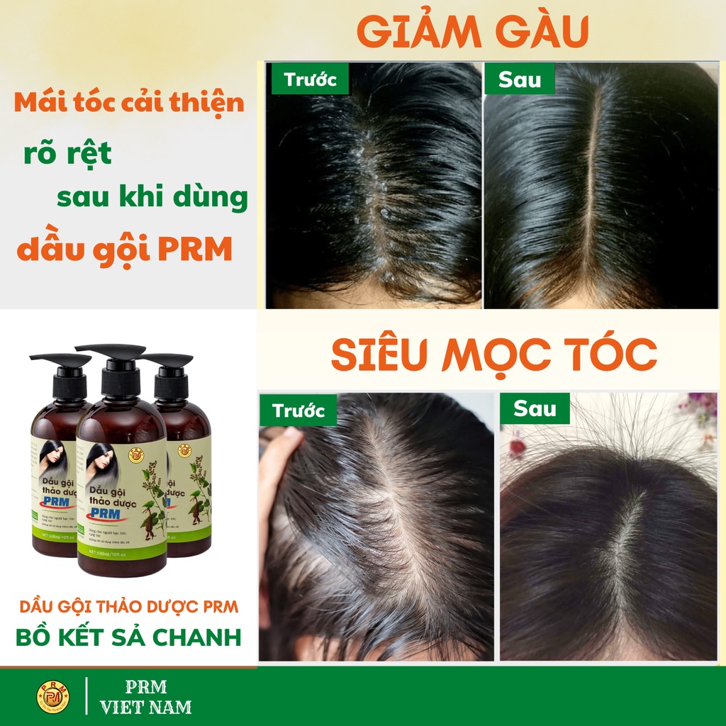 Dầu gội bồ kết cô đặc PRM chai 500ml, dầu gội thảo dược giúp kích mọc, giảm rụng tóc, giảm gàu | Bill Hair, Billhair