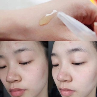 DƯỠNG CHẤT SÁNG DA VICHY 𝑳𝒊𝒇𝒕𝒂𝒄𝒕𝒊𝒗 𝑨𝒎𝒑𝒐𝒖𝒍𝒆𝒔 𝑷𝒆𝒑𝒕𝒊𝒅𝒆-𝑪 TÁCH LẺ