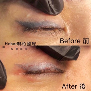Xoá Phun Xăm YD | Dụng Cụ Phun Xăm