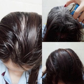 Dầu gội khô Batiste 200ml