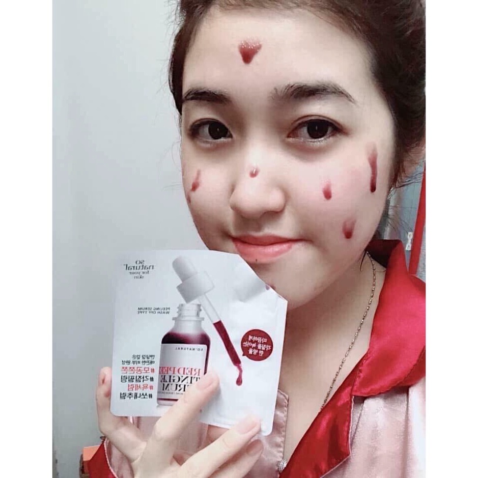 Tinh Chất Red Peel Tingle Serum Dạng Gói So Natural 2.5ml Hàn Quốc.