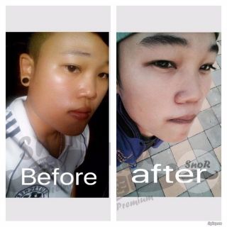 Mọc Tóc, Râu- Lông Mày-Tóc-SnoR Thái Lan