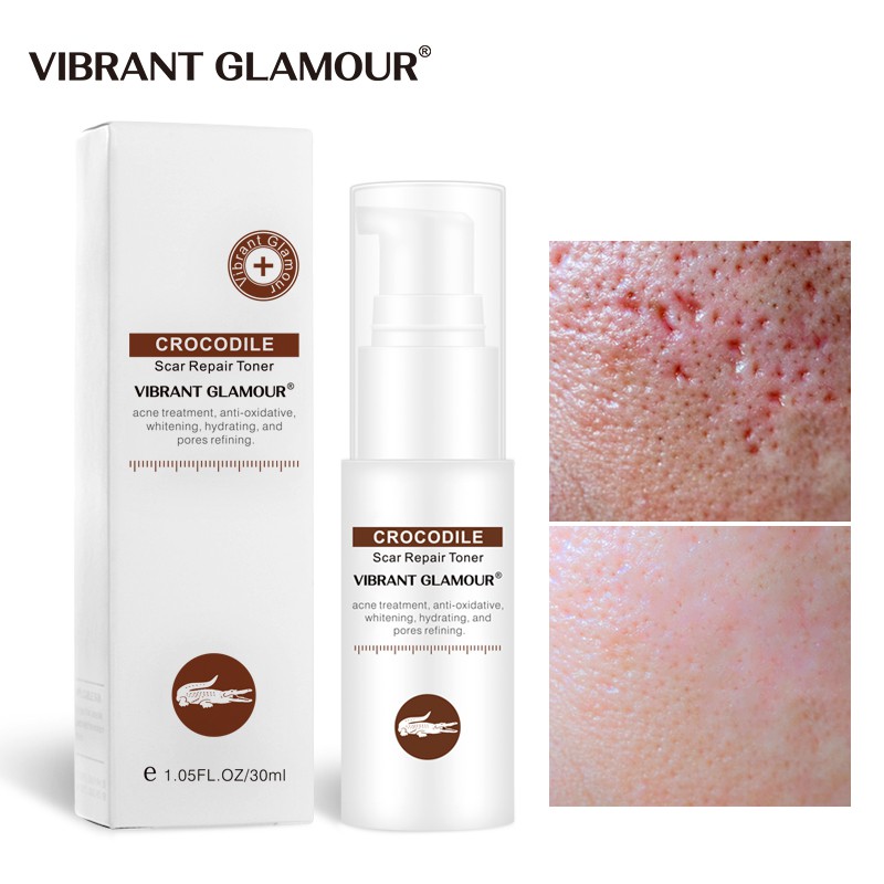 Toner VIBRANT GLAMOUR hỗ trợ giảm sẹo do mụn giảm vết rạn da cấp ẩm không gây nhờn dính phù hợp với mọi loại da 40ml