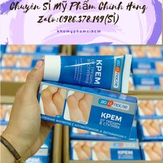 Kem trị nứt gót chân Nga Kpem 50ml