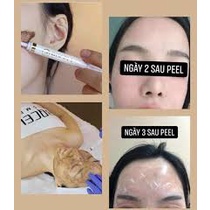 Thay Da Sinh Học - Peel Da Vi Tảo Bqcell  2G