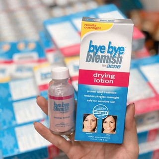 Kem Mụn Bye Bye Blemish Drying Lotion