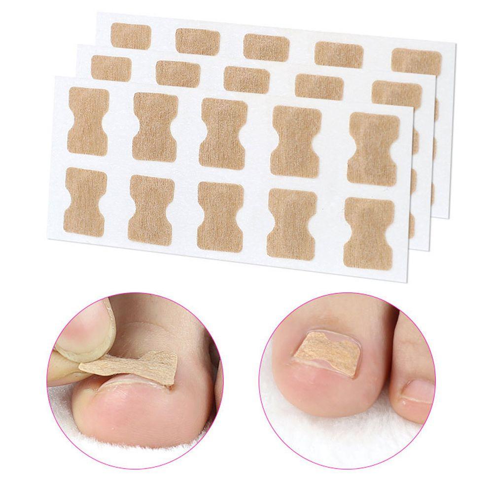 SOFTNESS Miếng Dán Chỉnh Hình Móng Chân Chuyên Nghiệp