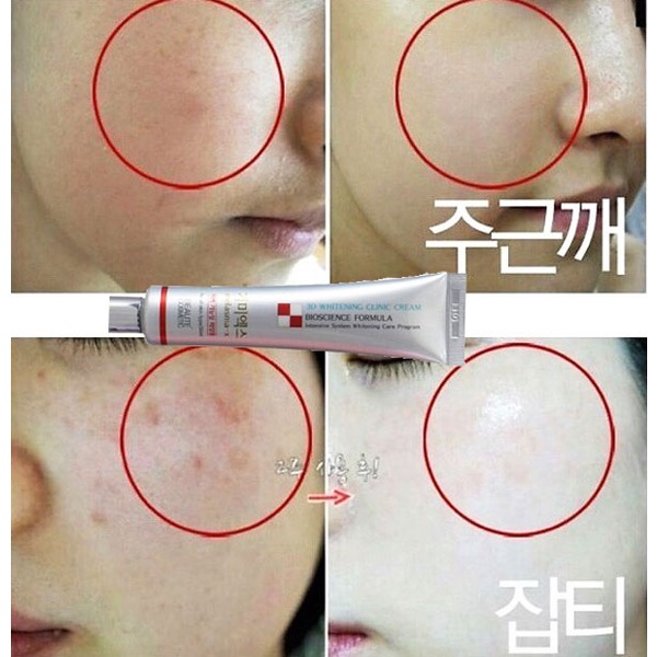 Combo Dưỡng Sáng Da Melasma Trẻ Hoá Cho Da Nám, Tàn Nhan