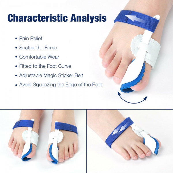 Dụng cụ điều chỉnh lệch ngón chân cái